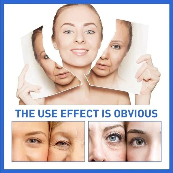 đ„Last Day Promotion 49% OFFđ„-Argireline Face Serum