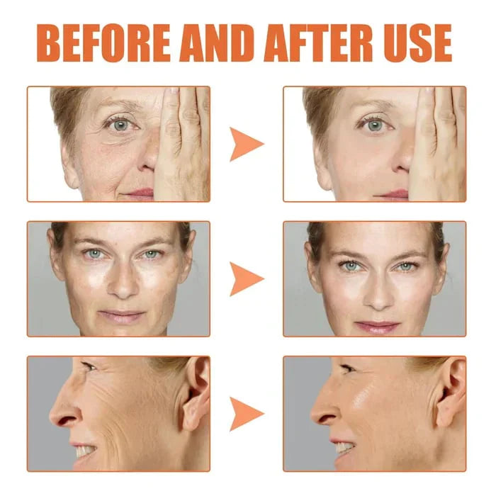đ„Last Day Promotion 49% OFFđ„-Argireline Face Serum