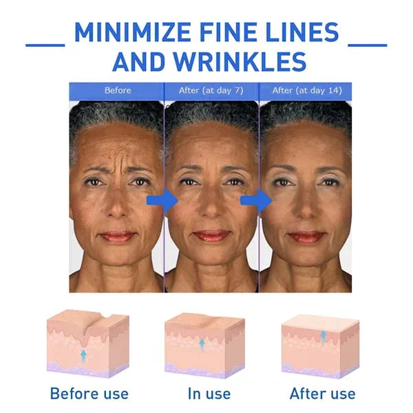 đ„Last Day Promotion 49% OFFđ„-Argireline Face Serum