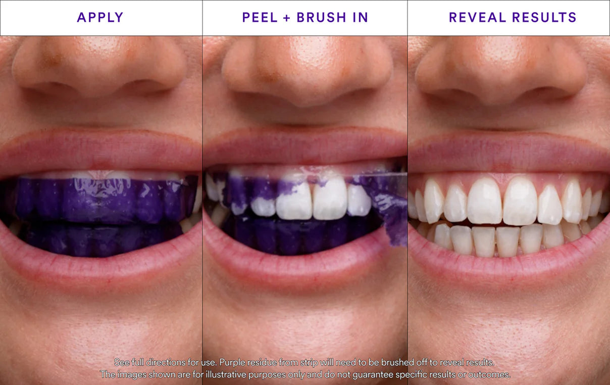 V34 Whitening Strips