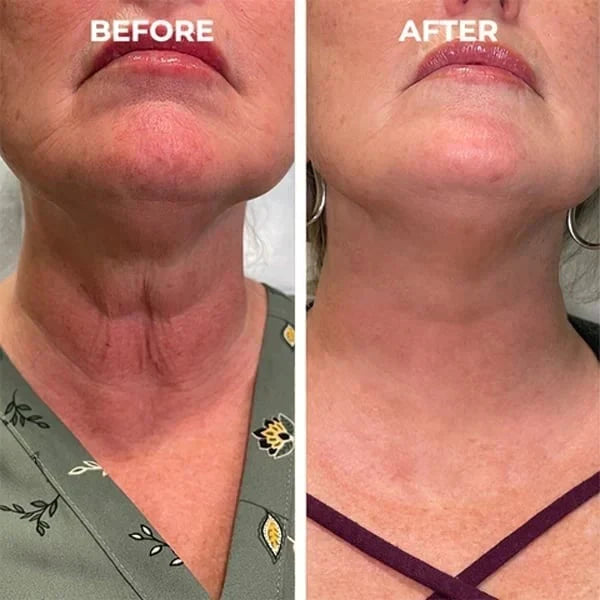 đ„Last Day Promotion 49% OFFđ„-Argireline Face Serum
