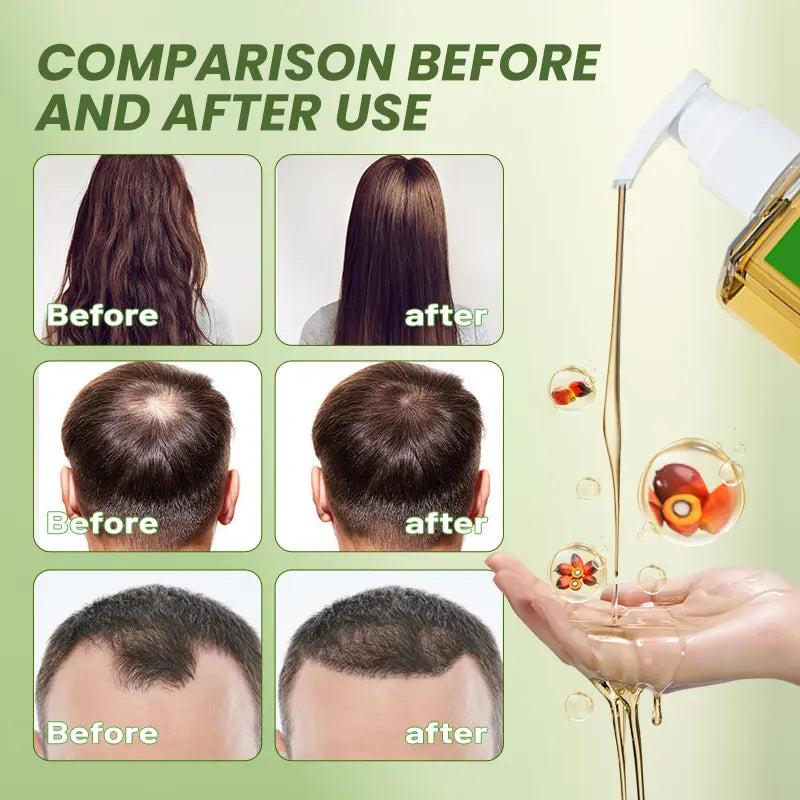 Batana Oil Shampoo: Growth - Boosting, Strengthening & Cleansing with Natural Extracts