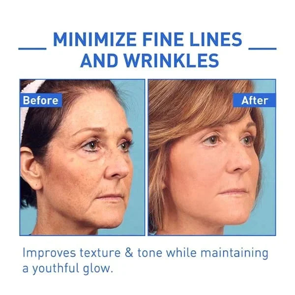 🔥Last Day Promotion 49% OFF🔥-Argireline Face Serum