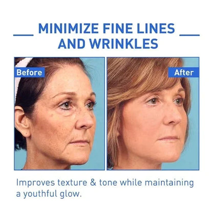 🔥Last Day Promotion 49% OFF🔥-Argireline Face Serum