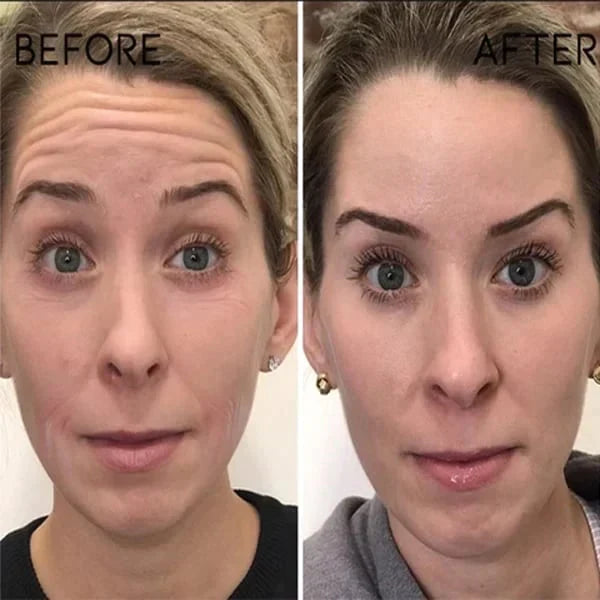 🔥Last Day Promotion 49% OFF🔥-Argireline Face Serum