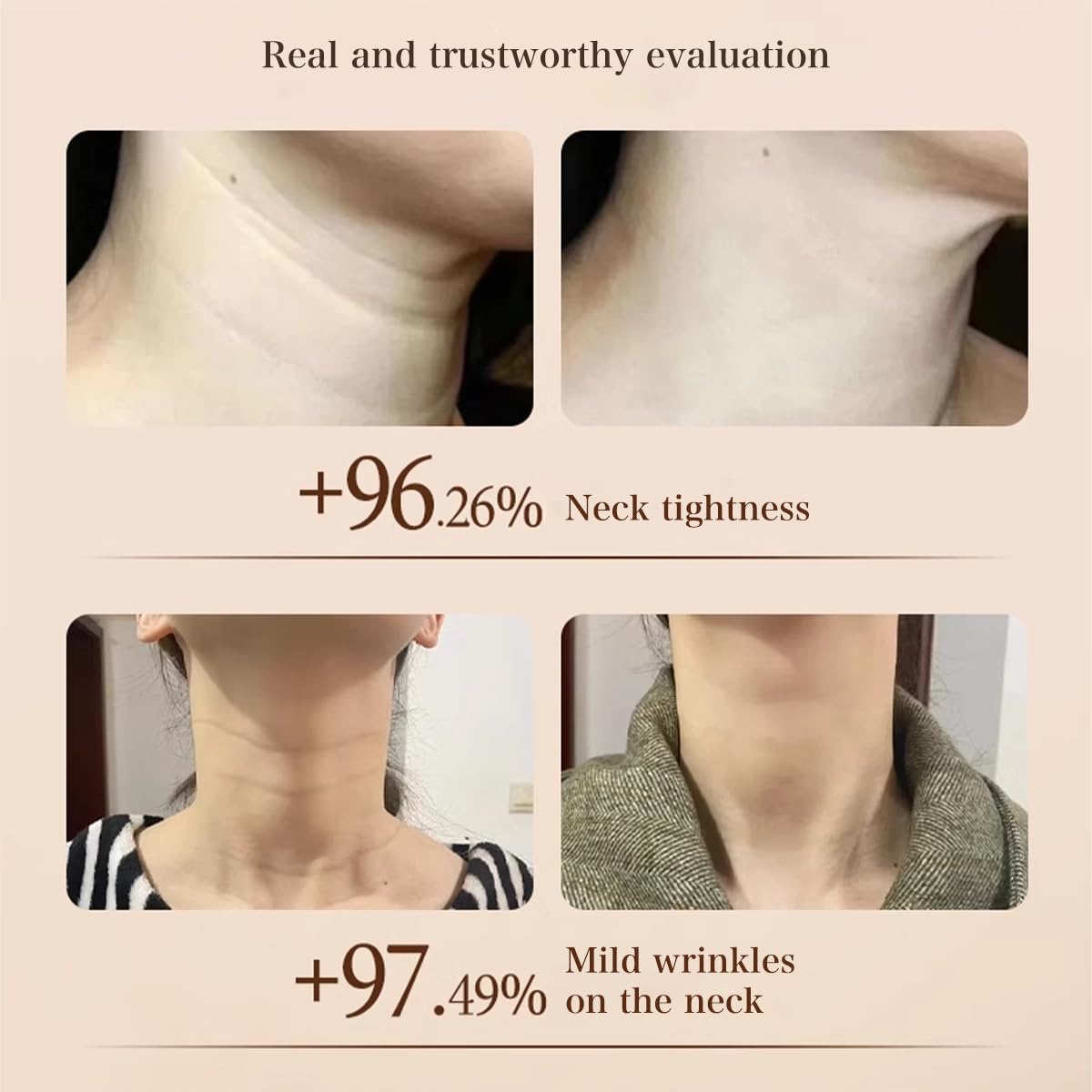 Nexisify™ Moisturizing & Firming Neck Cream, Reduces Fine Lines & Wrinkles, Silky Texture