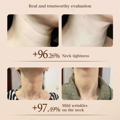 Nexisify™ Moisturizing & Firming Neck Cream, Reduces Fine Lines & Wrinkles, Silky Texture