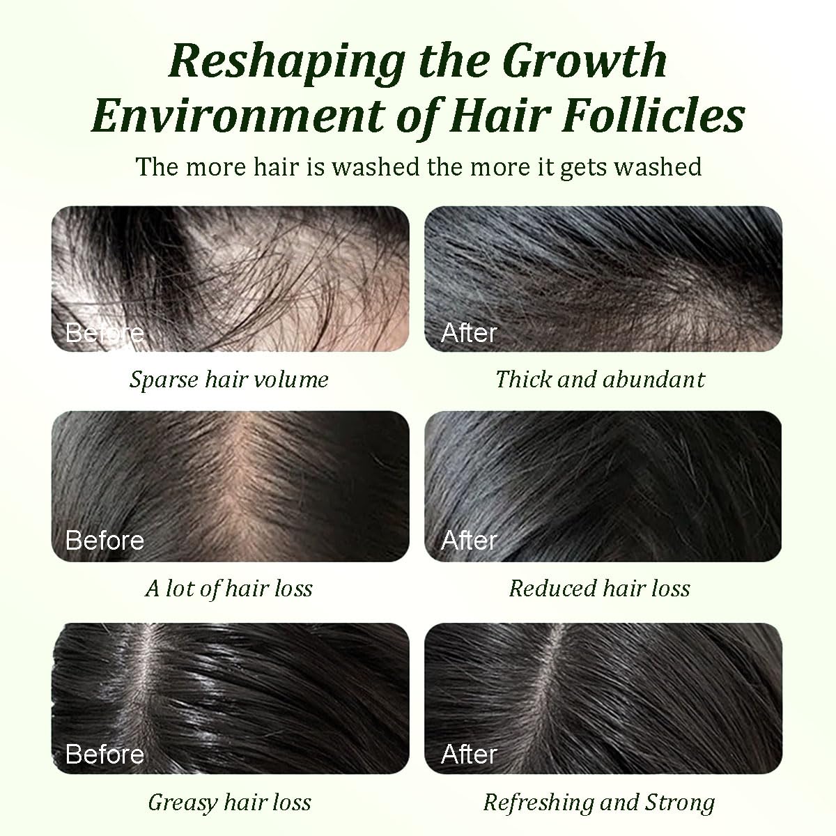 Batana Oil Shampoo: Growth - Boosting, Strengthening & Cleansing with Natural Extracts