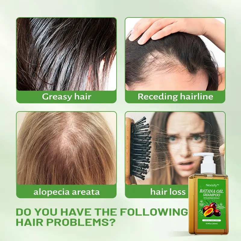 Batana Oil Shampoo: Growth - Boosting, Strengthening & Cleansing with Natural Extracts