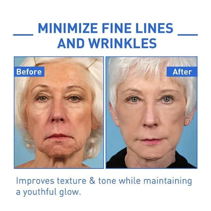 🔥Last Day Promotion 49% OFF🔥-Argireline Face Serum