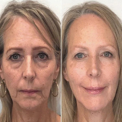 🔥Last Day Promotion 49% OFF🔥-Argireline Face Serum