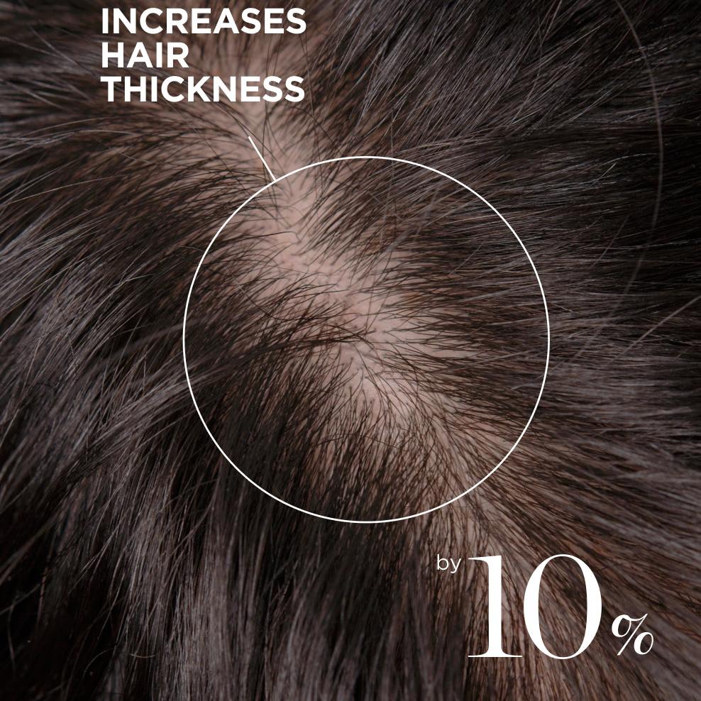 Scalp Revitalizing Solution Hair Thickening Roll On Serum, For Hair loss, Thinning Hair, Korean Hair Care